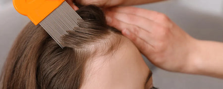 Poux dans les cheveux: comment les retirer soigneusement