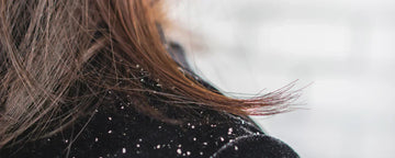 Woman with dandruff