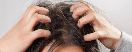 Sore and irritated scalp - Great guide on how to treat sore and irritated scalp
