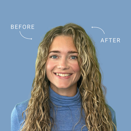 Locken- und Lautstärkerwurzelclips (6 PCs)