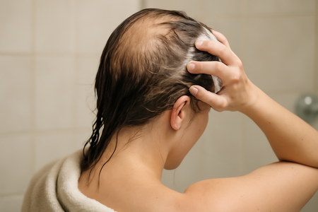 Postpartum hair regrowth timeline: What to expect month by month