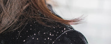 Woman with flaky scalp