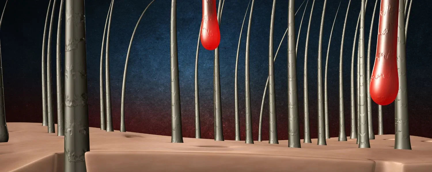 Damaged hair follicles