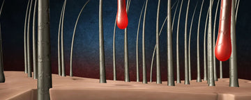 Damaged hair follicles