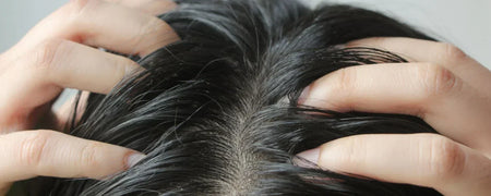 Pourquoi mes cheveux restent-ils gras après le lavage? Causes et solutions