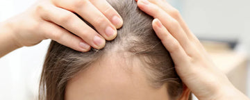 Small hairs in hairline