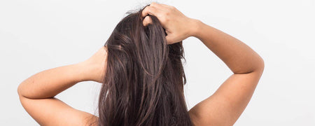 Cuir chevelu sec | Tout ce que vous devez savoir sur les pellicules, les démangeaisons et le cuir chevelu sec