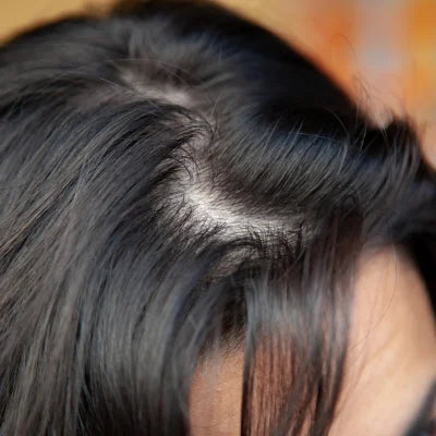 Cabello ralo