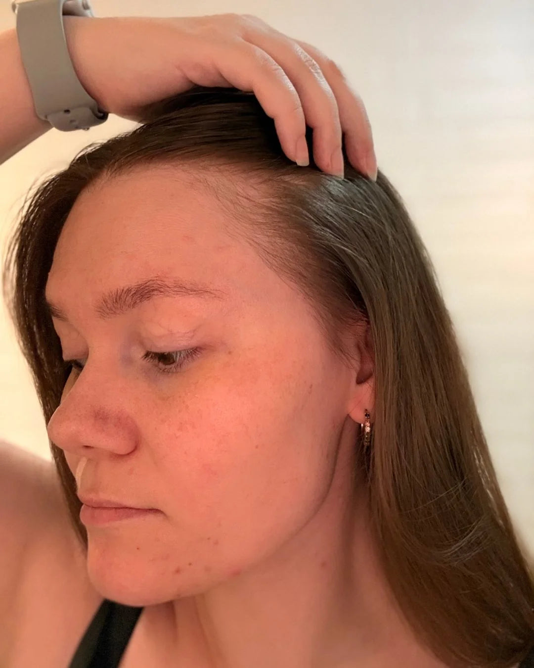 Before - Frederikke K.