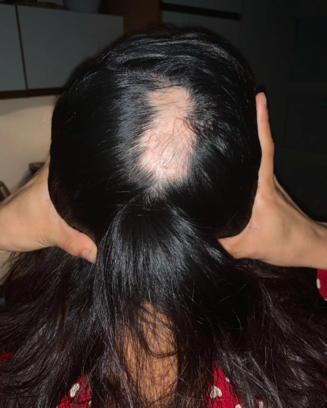 Before - Louise Kara