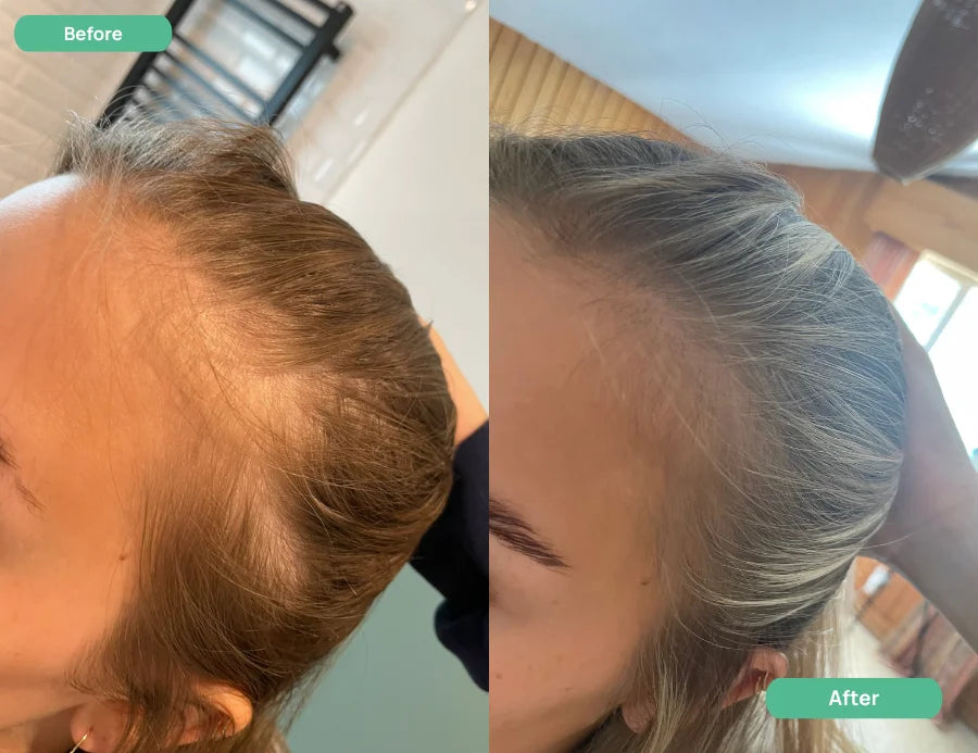 Comparación visual del volumen del cabello