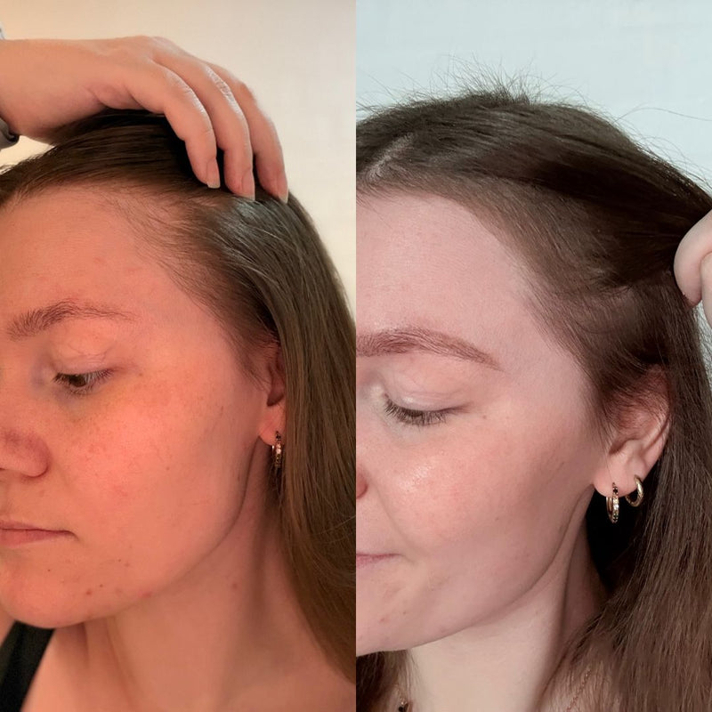 Ik heb mijn haar terug.