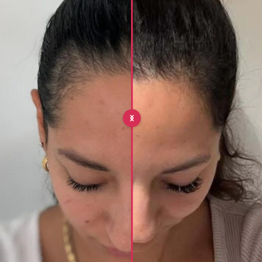 Het heeft mijn haar gered.